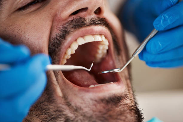 Best Emergency Cosmetic Dentistry (e.g., broken veneers) in Checotah, OK